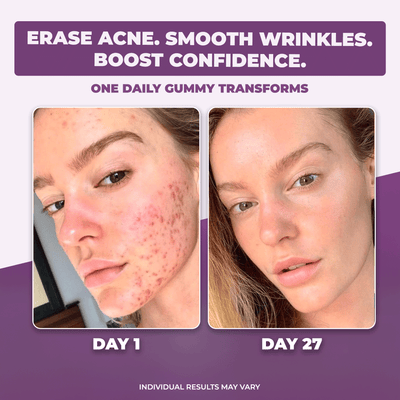 NuraGen Berry Bliss Gummies | Collagen + Biotin + NAD+